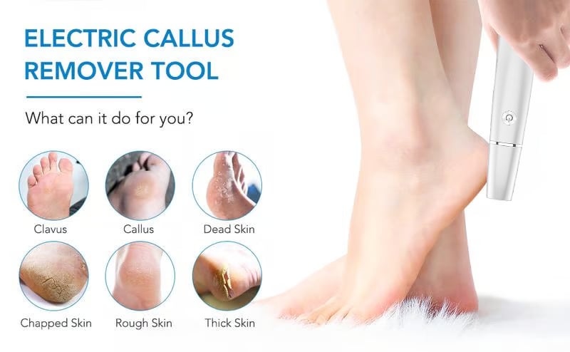 🌸New Year Hot Sale 49%🌸Electric Feet Callus Remover