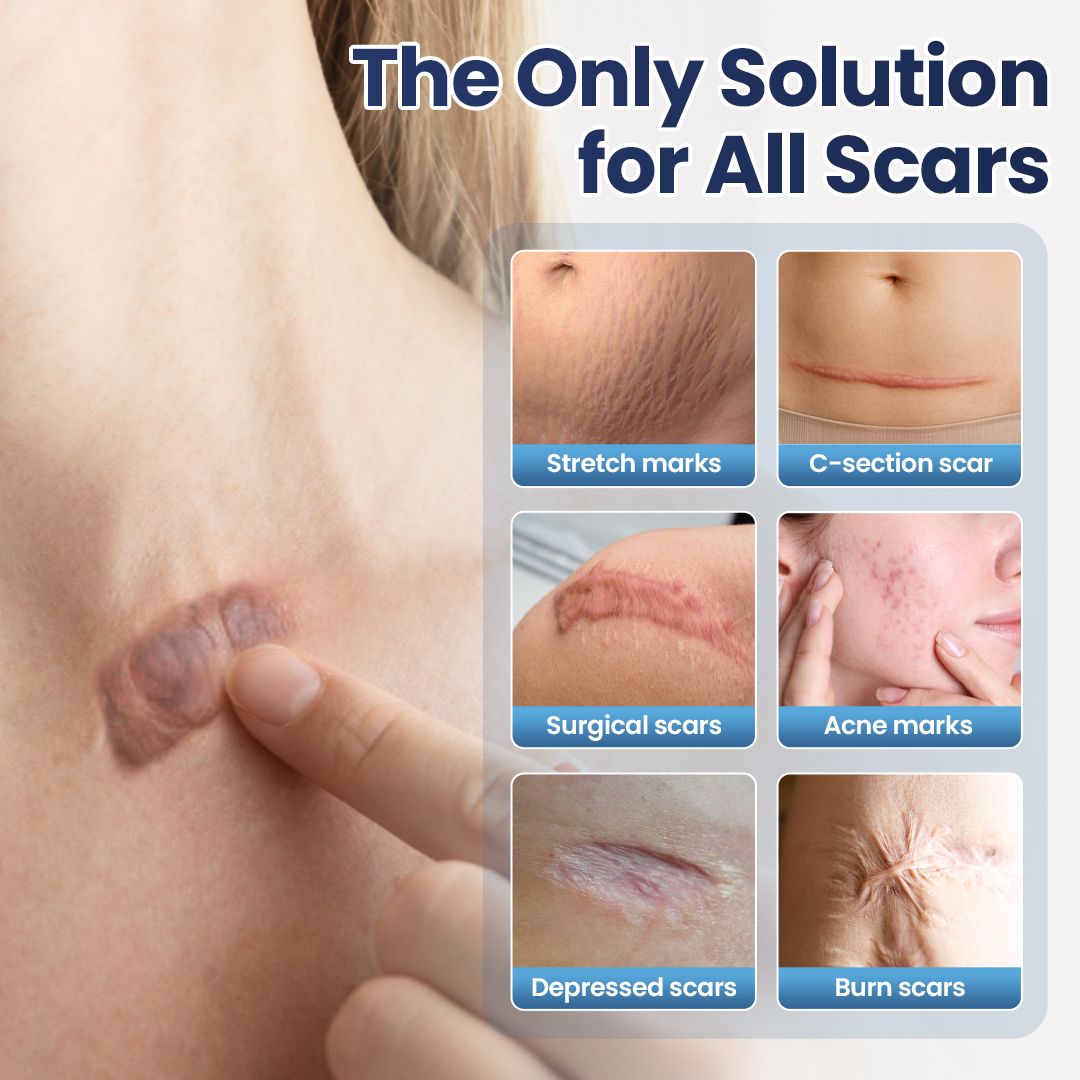 🔥Last Day Discount🔥 Gyrana® DERMALUX Texture Repair Gel