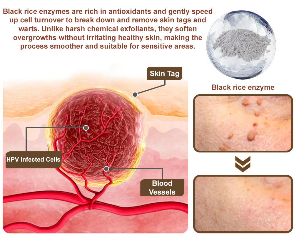 Virexo™ Black Rice Skin Repair Essence Cream (Removes warts and skin growths, improves keratin buildup and seborrheic dermatitis, follicular keratosis, age spots, and bruising)