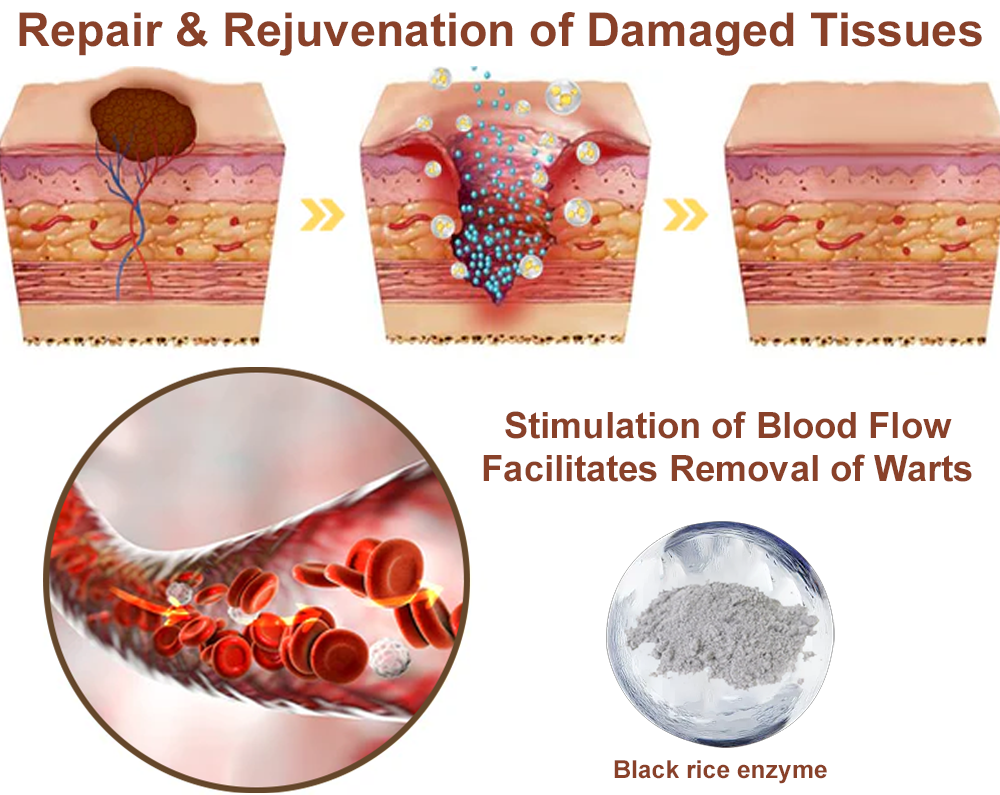 Virexo™ Black Rice Skin Repair Essence Cream (Removes warts and skin growths, improves keratin buildup and seborrheic dermatitis, follicular keratosis, age spots, and bruising)
