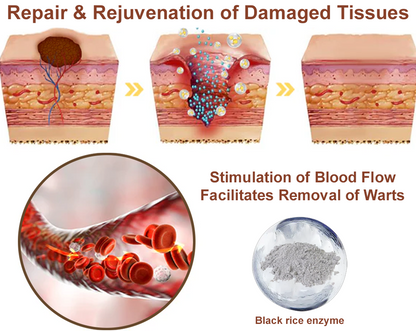 Virexo™ Black Rice Skin Repair Essence Cream (Removes warts and skin growths, improves keratin buildup and seborrheic dermatitis, follicular keratosis, age spots, and bruising)