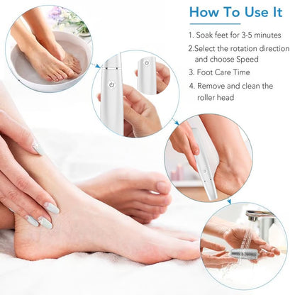 🌸New Year Hot Sale 49%🌸Electric Feet Callus Remover