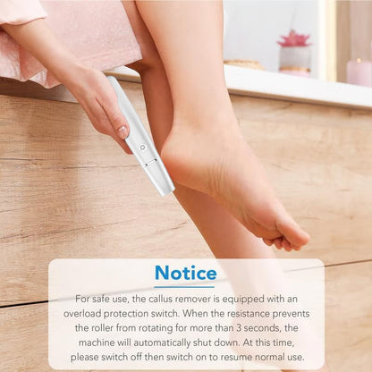 🌸New Year Hot Sale 49%🌸Electric Feet Callus Remover