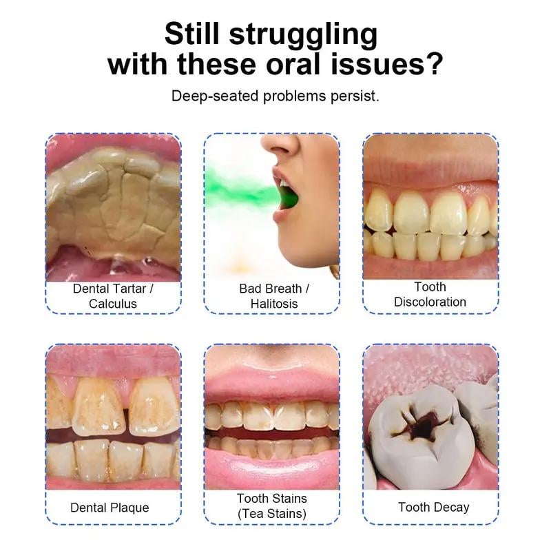 Professional Electric Scaler for Effective Plaque & Tartar Removal