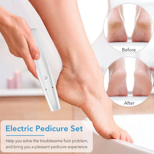 🌸New Year Hot Sale 49%🌸Electric Feet Callus Remover