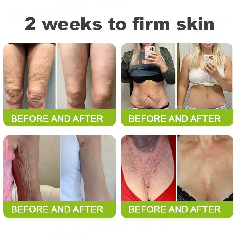 👨‍⚕️Made and shipped from Australia💫 Botox & Vita-A Retinol Shot Wrinkle-Lift Tightening cream - Last Day Promotion 70% OFF