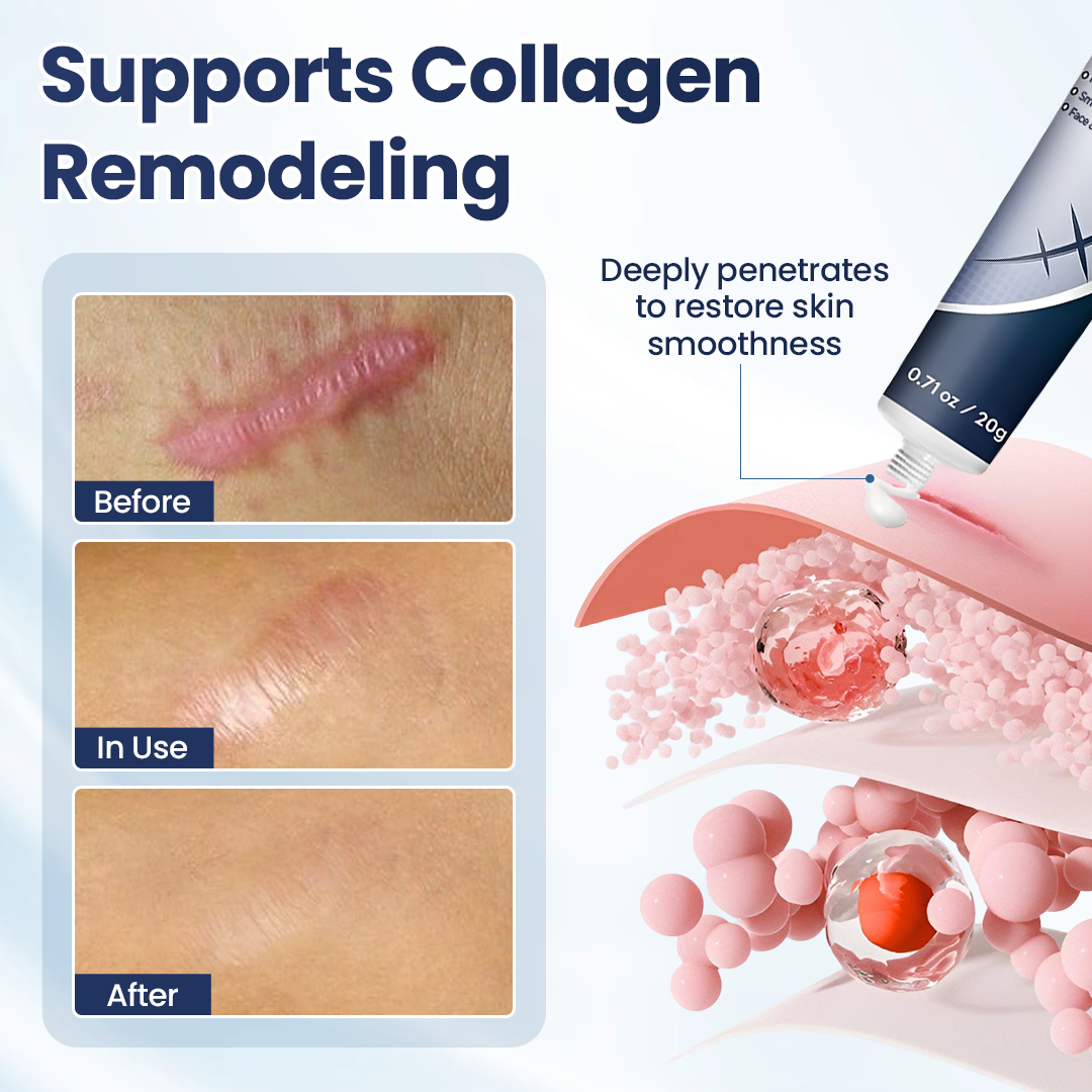 🔥Last Day Discount🔥 Gyrana® DERMALUX Texture Repair Gel