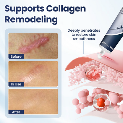 🔥Last Day Discount🔥 Gyrana® DERMALUX Texture Repair Gel