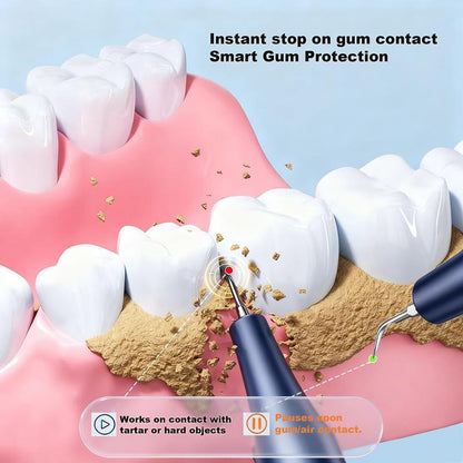 Professional Electric Scaler for Effective Plaque & Tartar Removal